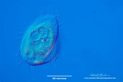  Coleps! A Tiny Ciliate Swimming Through Life With Hairy Elegance