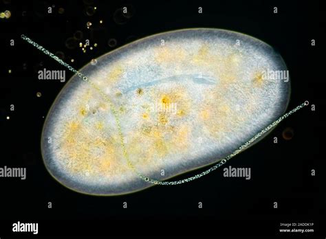  Frontonia:  Discover This Tiny Ciliate Who Loves To Eat Bacteria Like A Delicious Banquet!